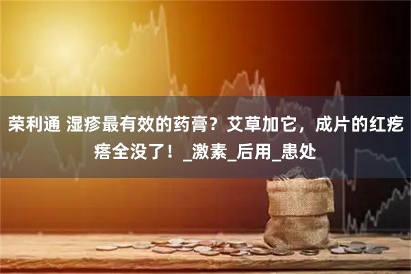 荣利通 湿疹最有效的药膏？艾草加它，成片的红疙瘩全没了！_激素_后用_患处